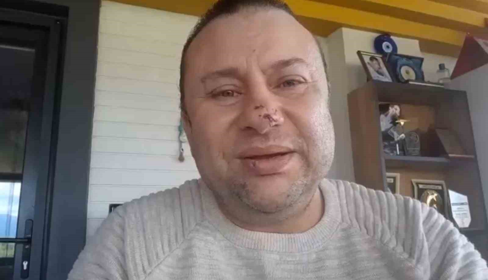 Pitbull saldırısına uğrayan Onur Akay o anları anlattı:  Ben ölümden döndüm 
?v=1