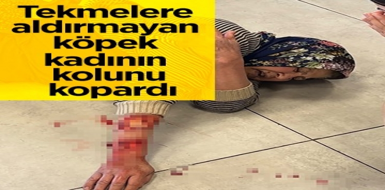 Tekmelere Aldırmayan Köpek Kadının Kolunu Kopardı?v=1
